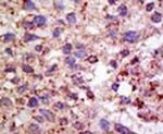 USP11 Antibody in Immunohistochemistry (IHC)