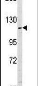 USP11 Antibody in Western Blot (WB)