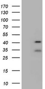 USP12 Antibody in Western Blot (WB)