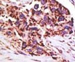 USP13 Antibody in Immunohistochemistry (IHC)