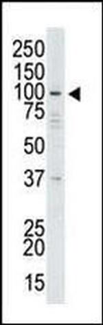 USP13 Antibody in Western Blot (WB)