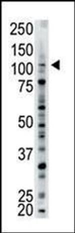 USP15 Antibody in Western Blot (WB)