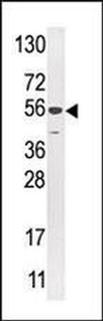 USP16 Antibody in Western Blot (WB)