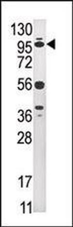 USP1 Antibody in Western Blot (WB)