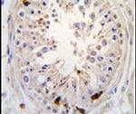 USP2 Antibody in Immunohistochemistry (IHC)