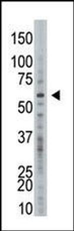 USP21 Antibody in Western Blot (WB)