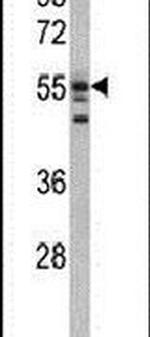 USP22 Antibody in Western Blot (WB)