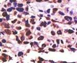 USP25 Antibody in Immunohistochemistry (IHC)