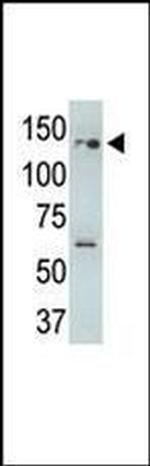 USP25 Antibody in Western Blot (WB)