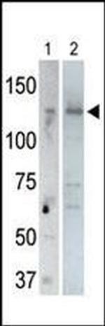 USP25 Antibody in Western Blot (WB)