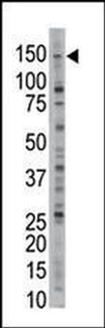 USP28 Antibody in Western Blot (WB)