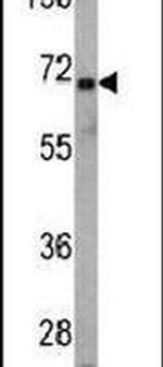 USP2 Antibody in Western Blot (WB)