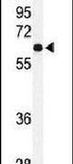 USP2 Antibody in Western Blot (WB)