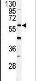 USP2 Antibody in Western Blot (WB)