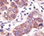 USP3 Antibody in Immunohistochemistry (IHC)