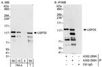 USP35 Antibody in Western Blot (WB)