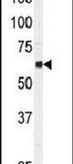 USP3 Antibody in Western Blot (WB)