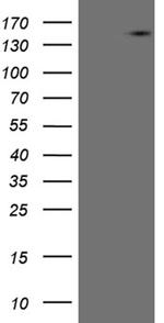 USP40 Antibody in Western Blot (WB)