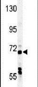 USP49 Antibody in Western Blot (WB)