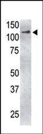 USP4 Antibody in Western Blot (WB)