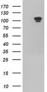 USP5 Antibody in Western Blot (WB)