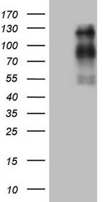 USP53 Antibody in Western Blot (WB)