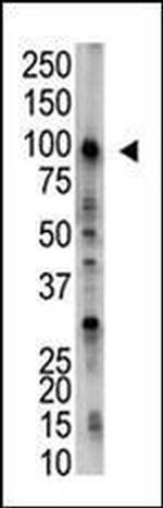USP5 Antibody in Western Blot (WB)