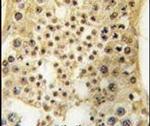 USP7 Antibody in Immunohistochemistry (IHC)