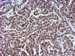 USP7 Antibody in Immunohistochemistry (Paraffin) (IHC (P))