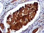 USP7 Antibody in Immunohistochemistry (Paraffin) (IHC (P))