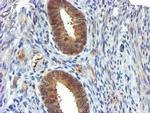USP7 Antibody in Immunohistochemistry (Paraffin) (IHC (P))