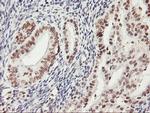 USP7 Antibody in Immunohistochemistry (Paraffin) (IHC (P))