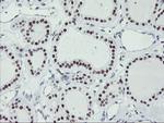 USP7 Antibody in Immunohistochemistry (Paraffin) (IHC (P))
