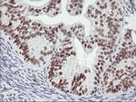 USP7 Antibody in Immunohistochemistry (Paraffin) (IHC (P))