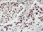 USP7 Antibody in Immunohistochemistry (Paraffin) (IHC (P))