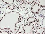 USP7 Antibody in Immunohistochemistry (Paraffin) (IHC (P))