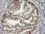 USP7 Antibody in Immunohistochemistry (Paraffin) (IHC (P))