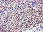 USP7 Antibody in Immunohistochemistry (Paraffin) (IHC (P))