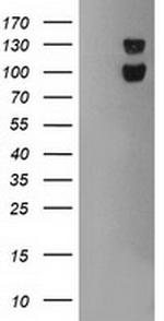 USP7 Antibody in Western Blot (WB)