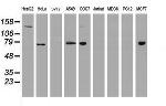 USP7 Antibody in Western Blot (WB)