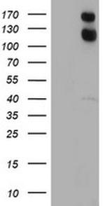 USP7 Antibody in Western Blot (WB)