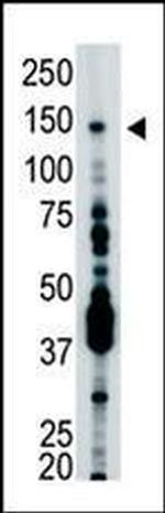USP7 Antibody in Western Blot (WB)