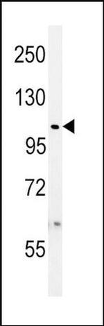 USP8 Antibody in Western Blot (WB)