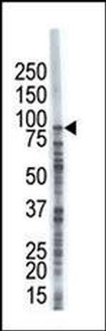 USP8 Antibody in Western Blot (WB)