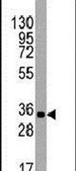 UTF1 Antibody in Western Blot (WB)