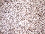 UTP11L Antibody in Immunohistochemistry (Paraffin) (IHC (P))