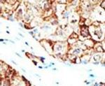 Ubiquilin 1 Antibody in Immunohistochemistry (IHC)