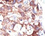 Ubiquilin 1 Antibody in Immunohistochemistry (IHC)