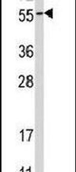 Ubiquilin 1 Antibody in Western Blot (WB)