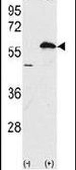 Ubiquilin 1 Antibody in Western Blot (WB)